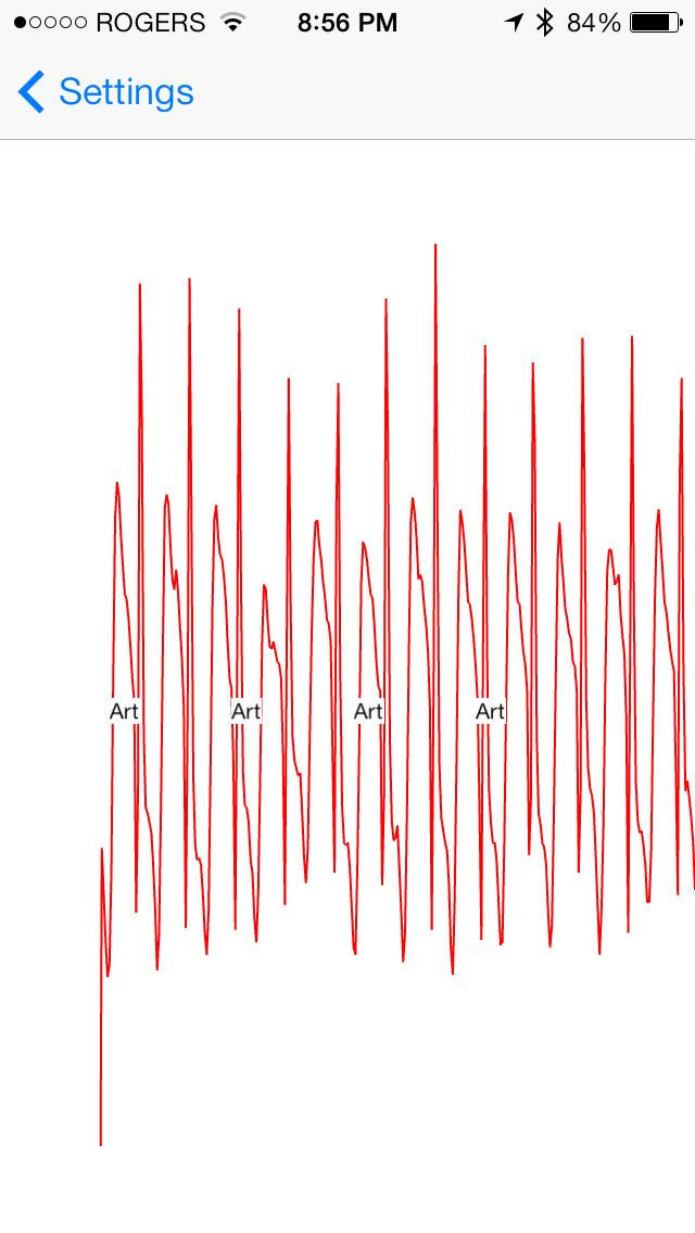 OMsignal Performance Metrics