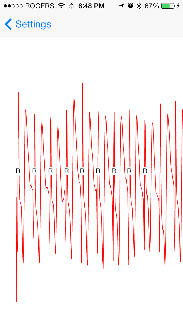 OMsignal Breathing Analysis
