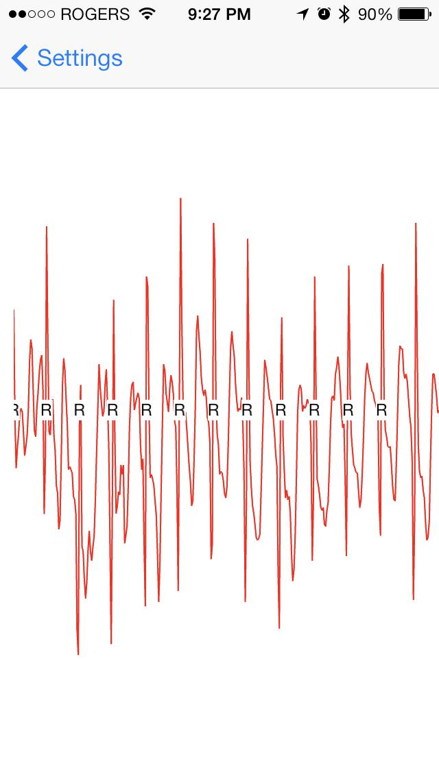 OMsignal Smart Clothing Technology